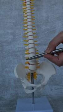 Artificial herniated disc and medical care structure and model of spine. Treatment of herniated discs and spinal diseases