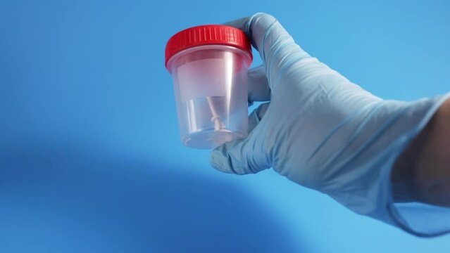 medical analysis,jar for urine and feces tests in the hands of a doctor in medical gloves on a blue background