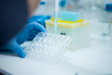 cell culture at the safety cabinet in cell culture laboratory, cancer and medicine research 