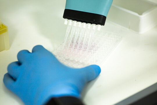 geneticist working with microplate for cells analysis in the genetic lab. Researcher working with samples of tissue culture in microplate in the bioengineering laboratory