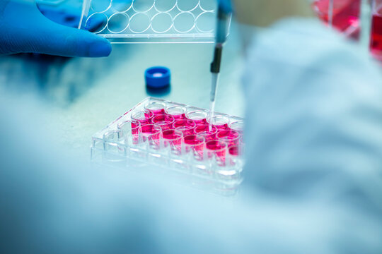 geneticist working with microplate for cells analysis in the genetic lab. Researcher working with samples of tissue culture in microplate in the bioengineering laboratory