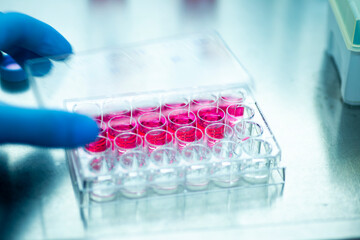 geneticist working with microplate for cells analysis in the genetic lab. Researcher working with samples of tissue culture in microplate in the bioengineering laboratory