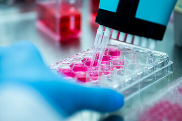 geneticist working with microplate for cells analysis in the genetic lab. Researcher working with samples of tissue culture in microplate in the bioengineering laboratory