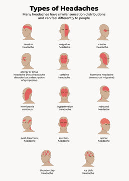 Types of headache. medical poster and infographic.neurology information. Medicine vector illustratuion.