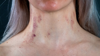 Fototapeta premium Domestic Violence Victim. A Young Unhappy Woman with Traces of beatings