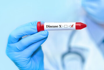Doctor holding a test blood sample tube with positive Disease X test.The world is preparing for new...