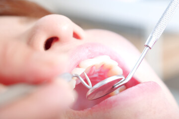 歯科治療を受ける女性