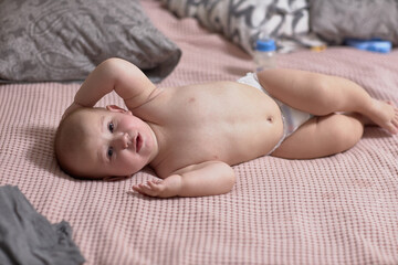 Roseola of the course of the disease in the baby, rash on the skin, the baby is capricious and...