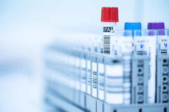 Blood test tube isolated and barcode label on white background.Laboratory medical concept.Technician and blood test tube at lalaboratory unit.