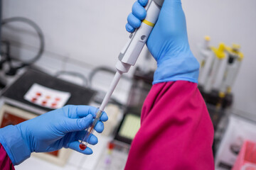 hands with rubber gloves using pipettes when drawing blood into small tubes in the laboratory