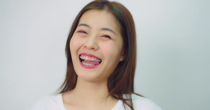Happy beautiful asian girl with braces. She looking to camera with attractive smiling at white background.