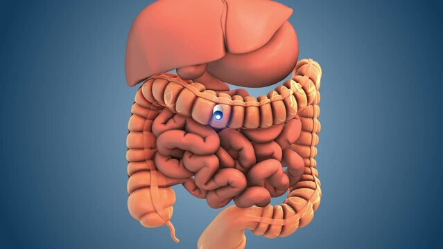 Medical concept of capsule endoscopy technique