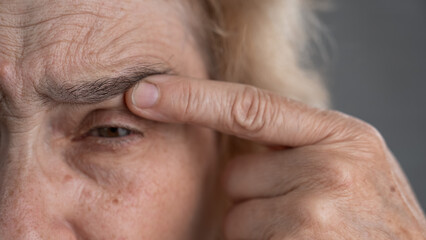 Close-up portrait of an old woman pointing at a wrinkle on her upper eyelid. 