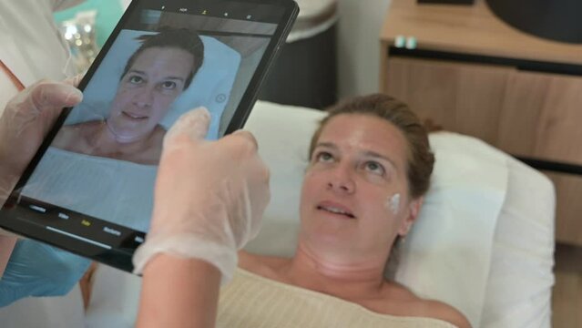 From above cropped unrecognizable clinician compares a patient's before-and-after photos on a tablet during a dark circle treatment session