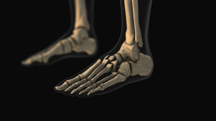 Medical animation of the metatarsal and phalanges bone pain