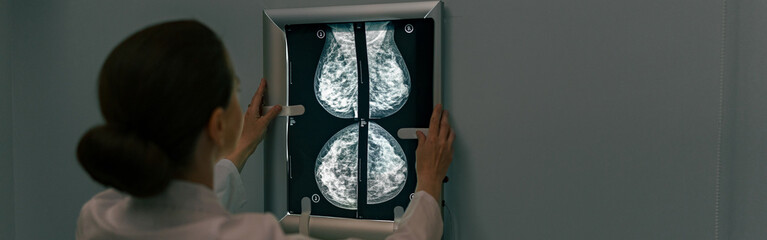 Female doctor neuroscientist analyzing scan MRI images in hospital. High quality photo - obrazy, fototapety, plakaty