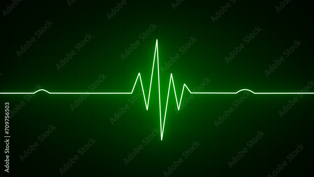 Wall mural Green neon Heart pulse monitor with signal. Heartbeat line. Flat line EKG, Pulse trace. EKG and Cardio symbol. Healthy and Medical concept