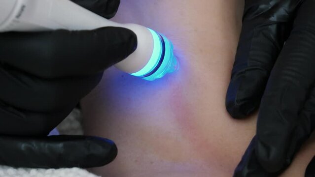 Vacuum cleaning and polishing neck skin of unrecognizable woman in cosmetology clinic, closeup. Non surgery cosmetology skincare. Professional moisturizing and rejuvenating hardware procedures