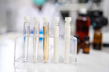 A sample test tube of fat, milk, glucose and protein in laboratory, dairy factory product analyze, quality checking and control test, microbiology technician scientist or nutrition test and experiment