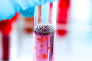 Culture Media in bottle, Culture media used in laboratory