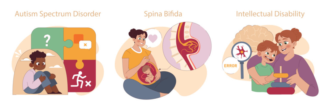 Kid Disability set. Autism, spina bifida, and intellectual disability portrayed with care and understanding. Focus on unique challenges and nurturing support.