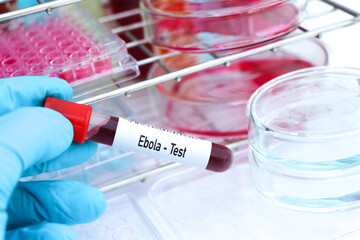 Ebola test to look for abnormalities from blood