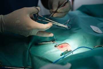 Focus on surgical instruments during a surgical intervention. Concept: hospital, surgery, medicine