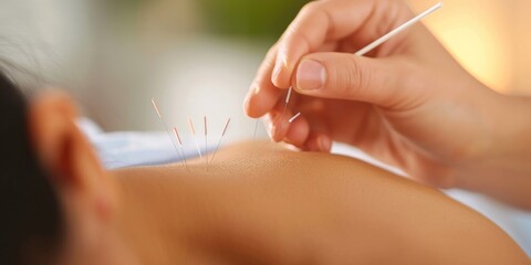 Close up shot of an acupuncture therapy process with steel needles during a procedure