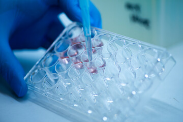 cell culture at the medicine  medical and cell culture laboratory