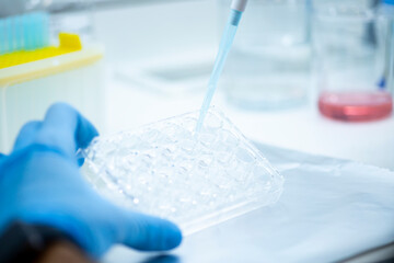 cell culture at the medicine  medical and cell culture laboratory