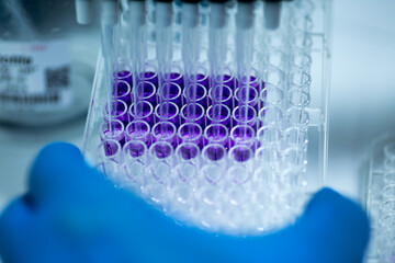 cell culture at the medicine  medical and cell culture laboratory