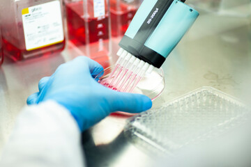 cell culture at the medicine  medical and cell culture laboratory