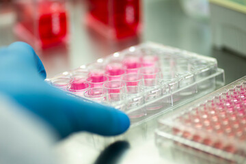 cell culture at the medicine  medical and cell culture laboratory