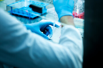 cell culture at the medicine  medical and cell culture laboratory
