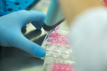 cell culture at the medicine  medical and cell culture laboratory