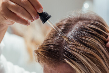 Woman applies oil to her hair with pipette. Beauty caring for scalp and hair