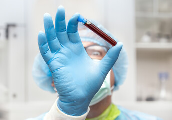 The doctor hold test tube with a testing blood, focus on a hand, blurred face. Research blood of...