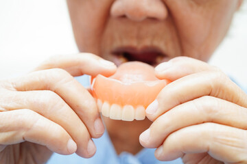 Asian senior woman patient holding teeth denture in her hand for chew food.