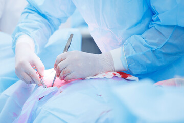 Surgery doctor sews up punctures in abdominal cavity with thread after using laparoscopic...