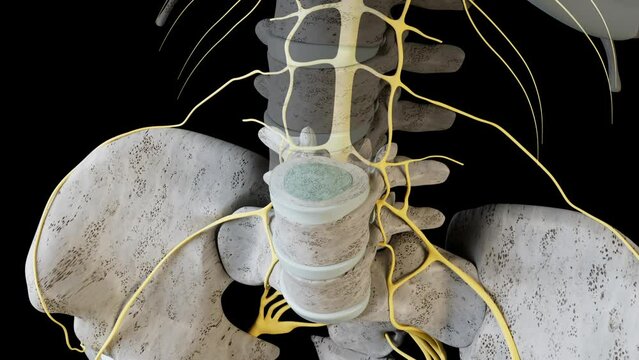 Bulging Disc Overview