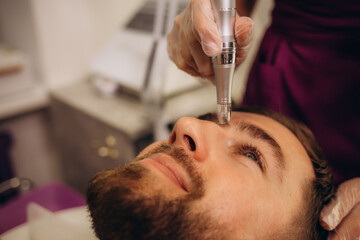 Dermastamp fractional mesotherapy treatment for man in cosmetology clinic.