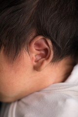 Fototapeta premium Little newborn baby earlobe earring ear preauricular appendix listen
