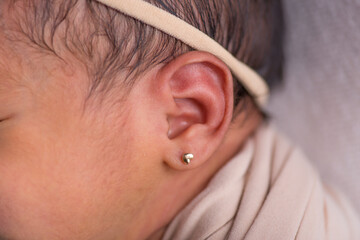 Little newborn baby earlobe earring ear preauricular appendix listen