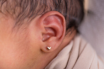 Naklejka premium Little newborn baby earlobe earring ear preauricular appendix listen
