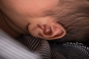 Little newborn baby earlobe earring ear preauricular appendix listen - obrazy, fototapety, plakaty