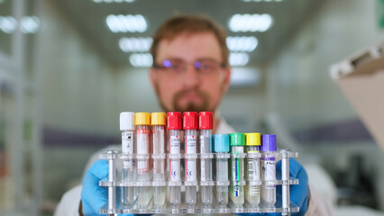 A scientist holds in his hands scientific laboratory test tubes for blood analysis. Clinic doctor, medical technician conducts laboratory testing of blood samples.