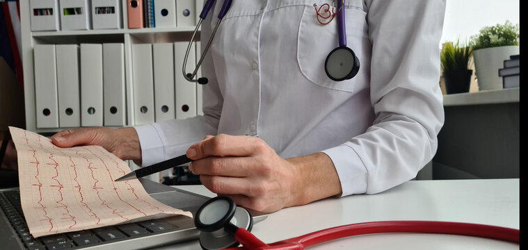 Female cardiologist checking cardiogram of patient with pen in hand
