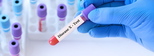Doctor holding a test blood sample tube with Disease X test.The world is preparing for a new...