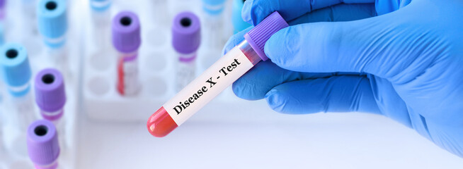Fototapeta premium Doctor holding a test blood sample tube with Disease X test.The world is preparing for a new mysterious pandemic 