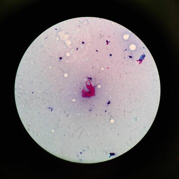 TBC Under Microscope